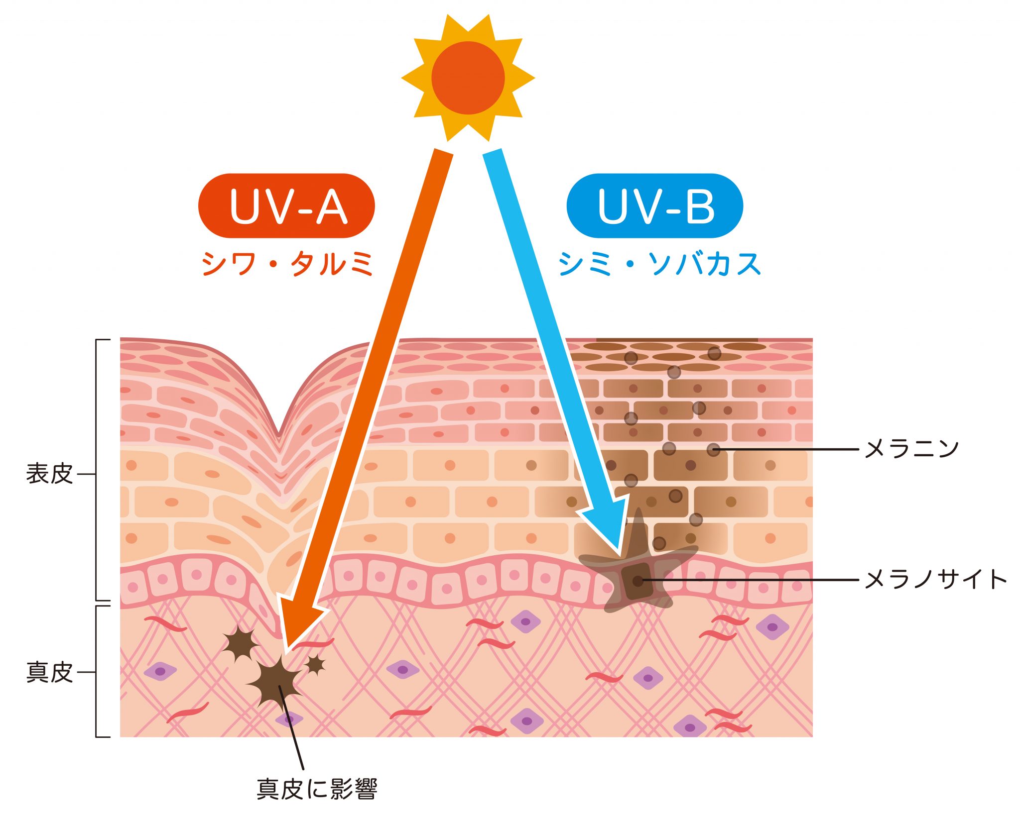 UV-A  UV-B
