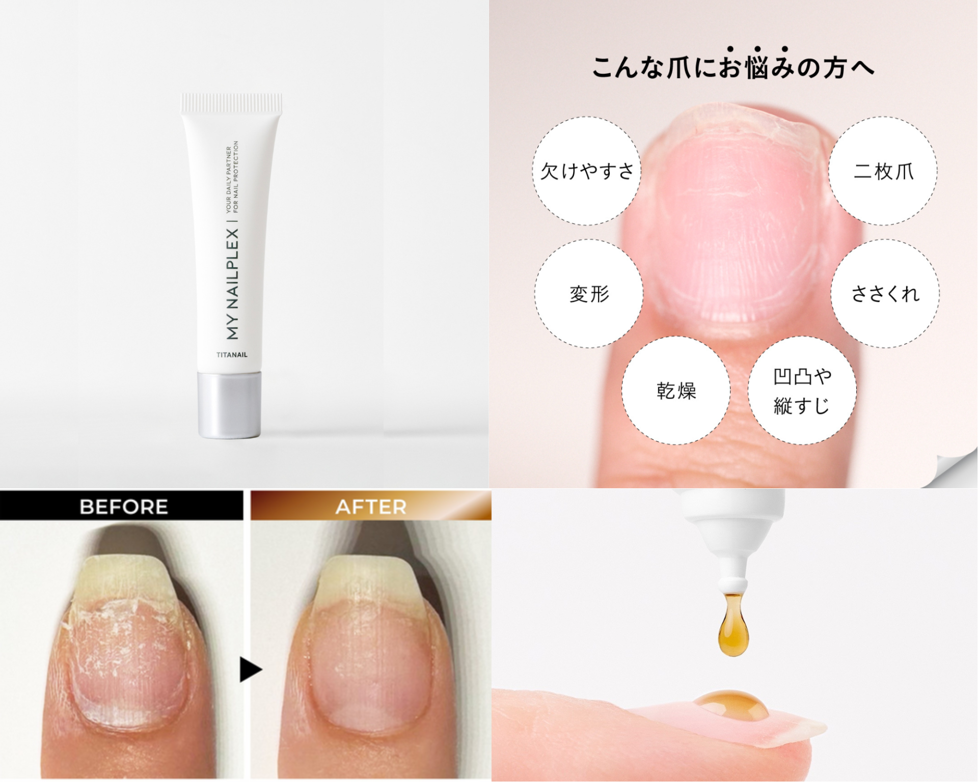 MY NAILPLEX(マイネイルプレックス)