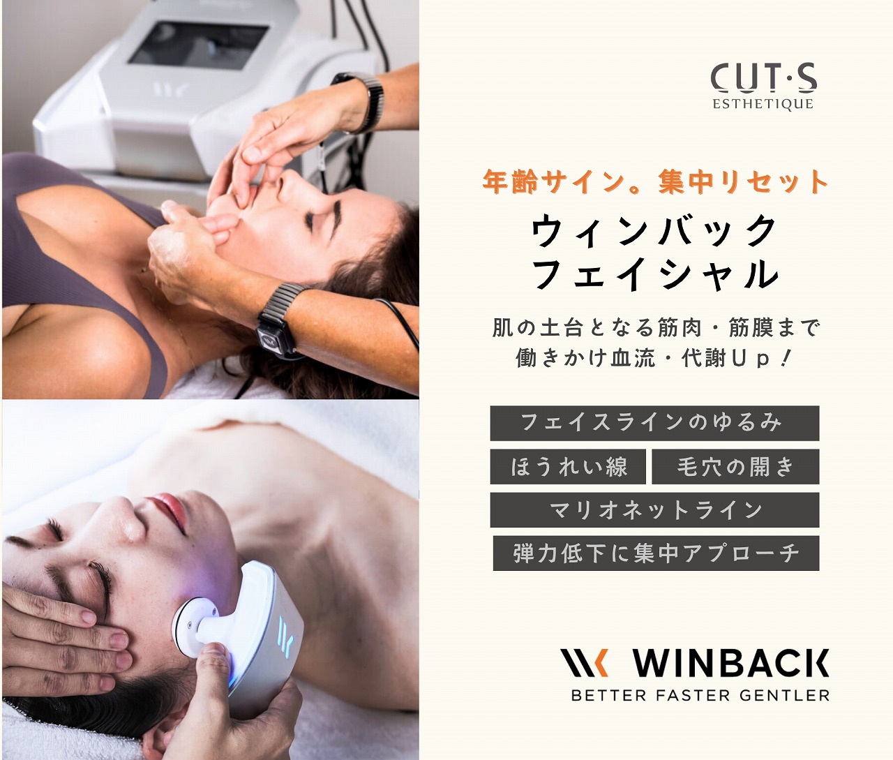 WINBACKフェイシャル
