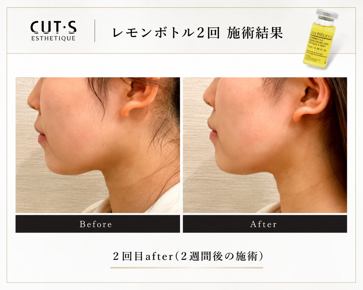レモンボトルbefore after
